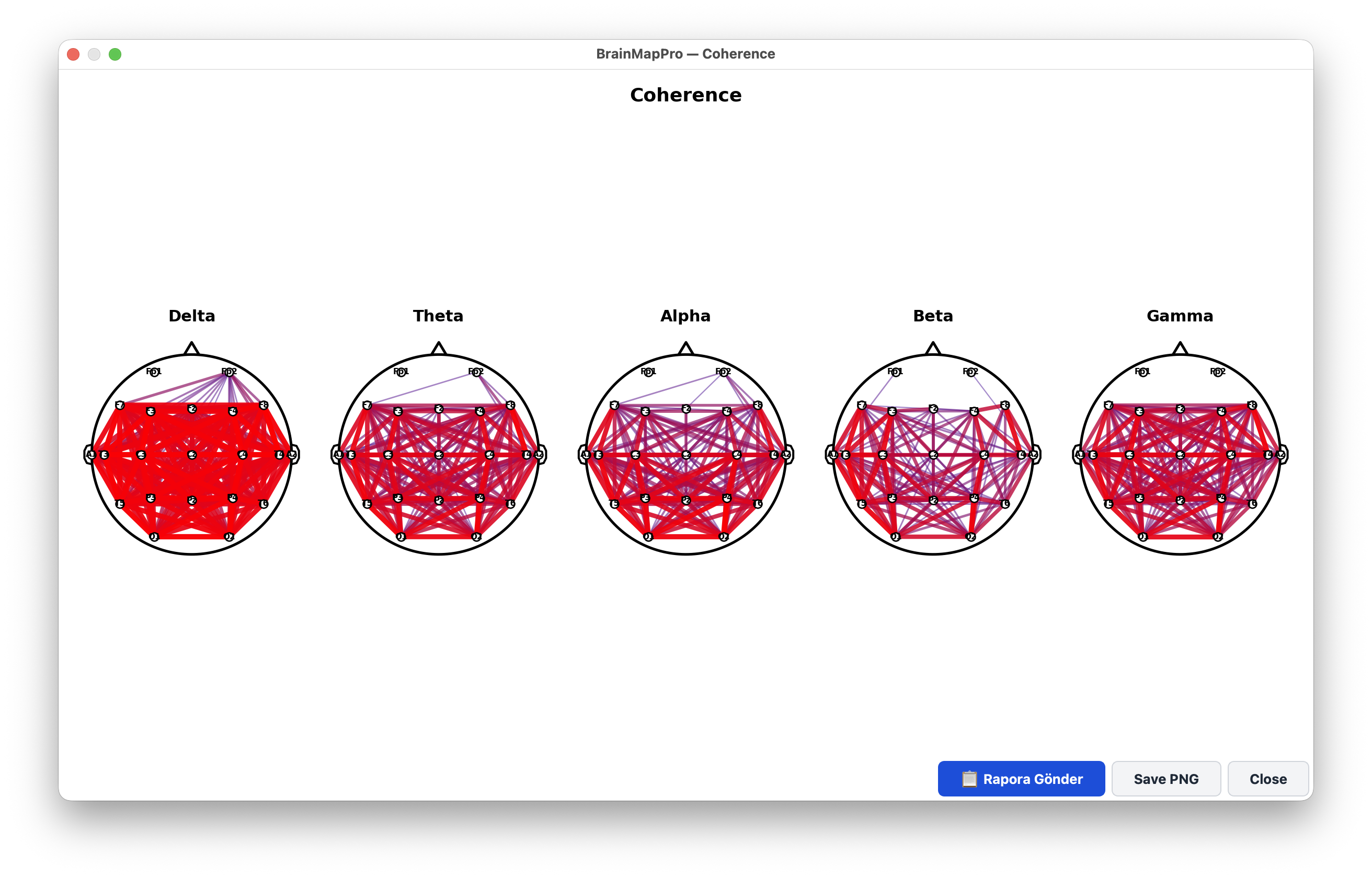 Coherence connectivity maps for all frequency bands