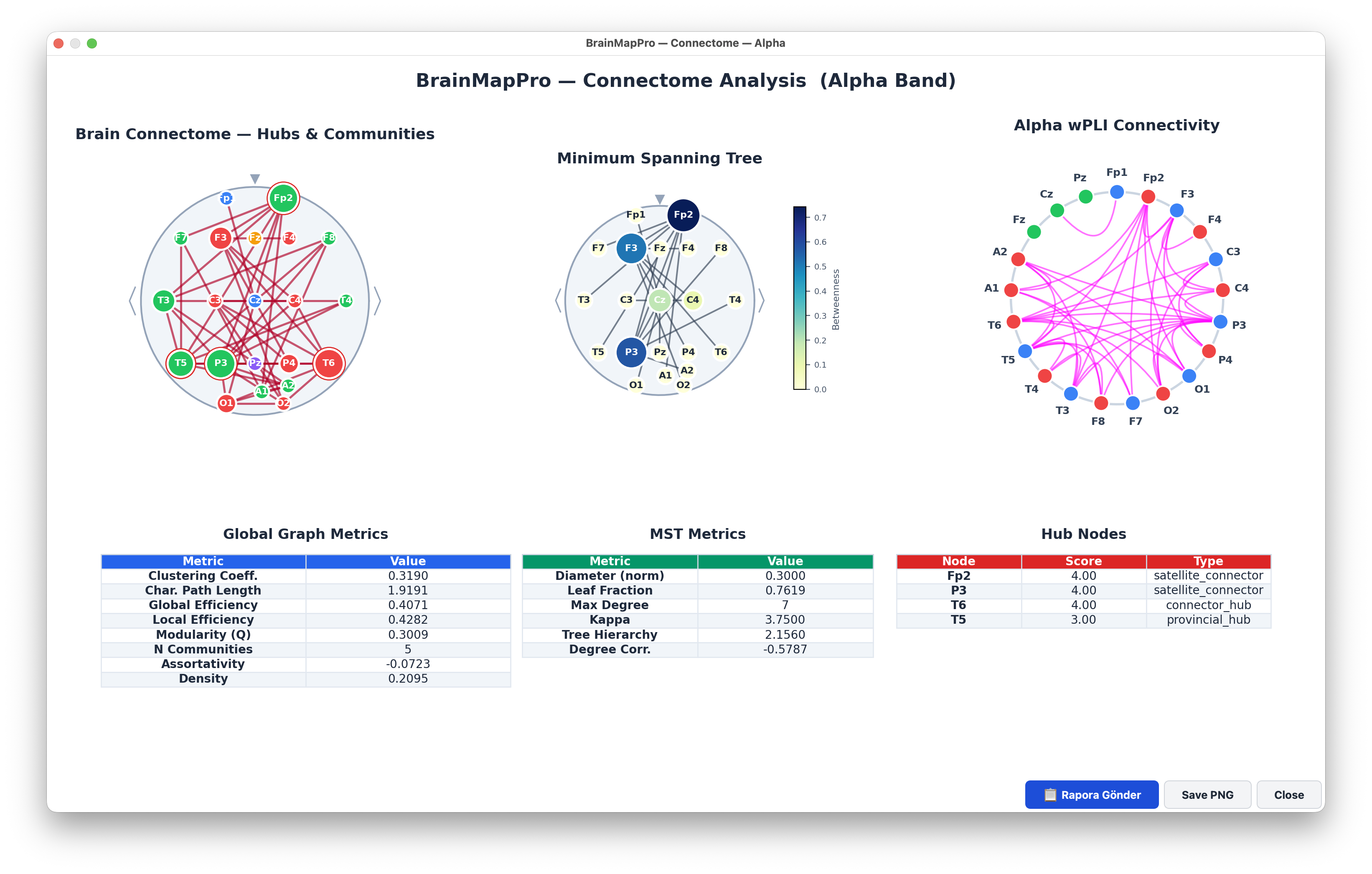 Connectome analysis for Alpha band