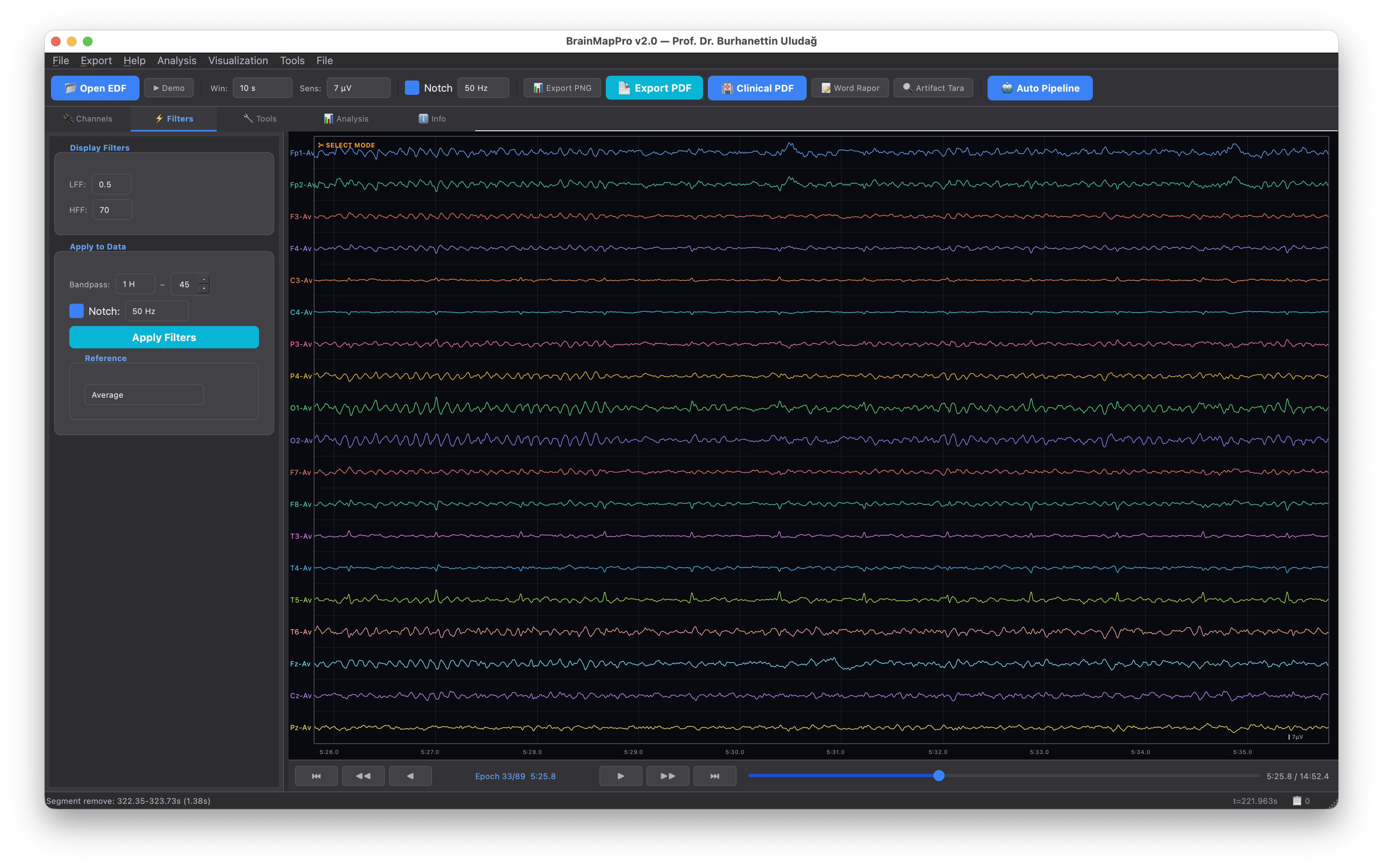 BrainMapPro — 19-channel EEG analysis with dark clinical interface