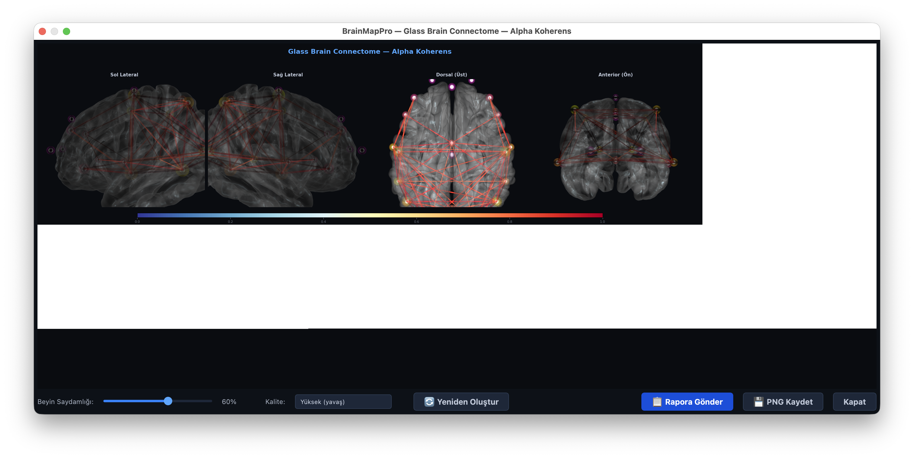 3D glass brain with Alpha coherence connectivity