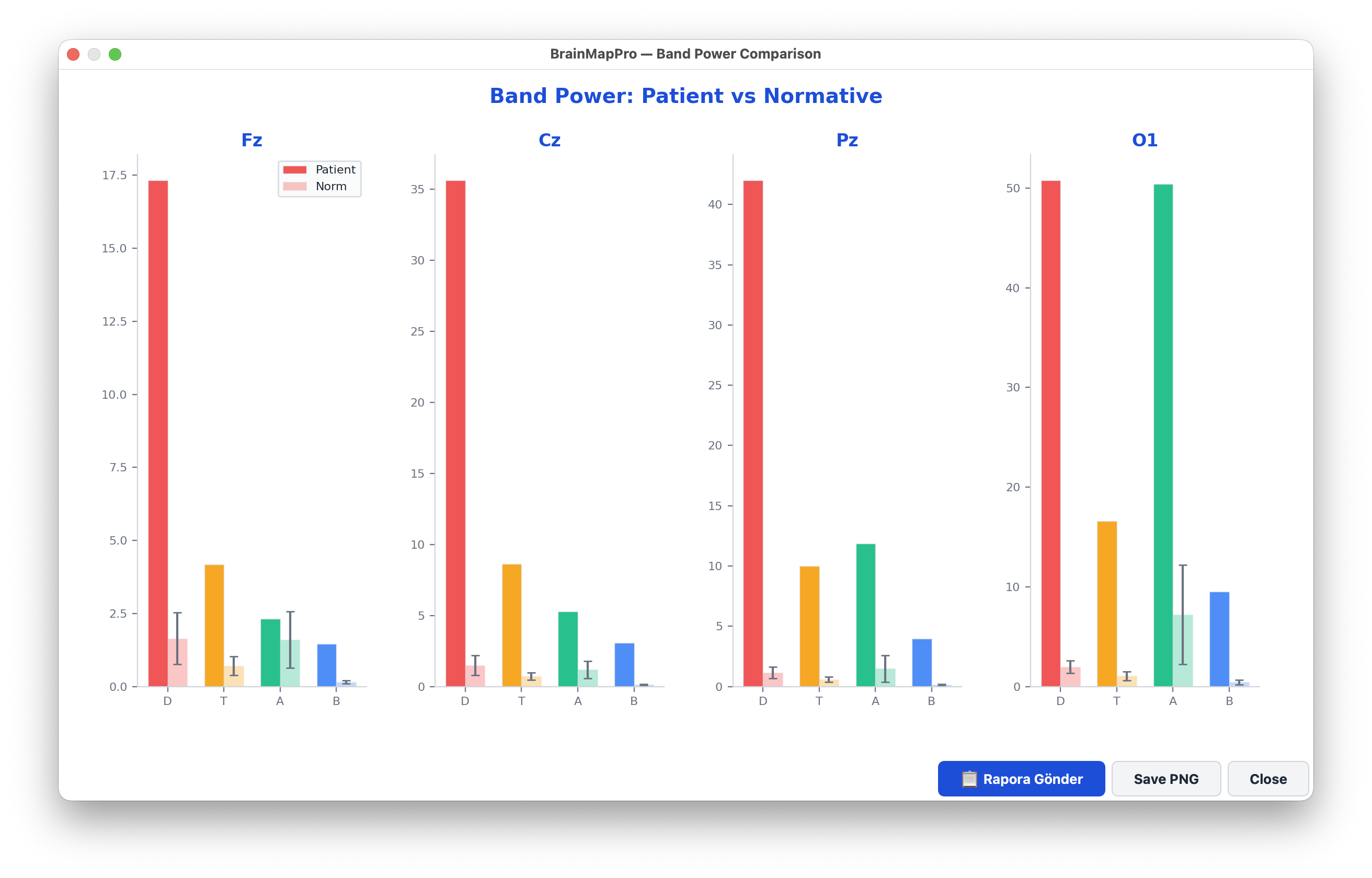 Patient vs normative band power comparison