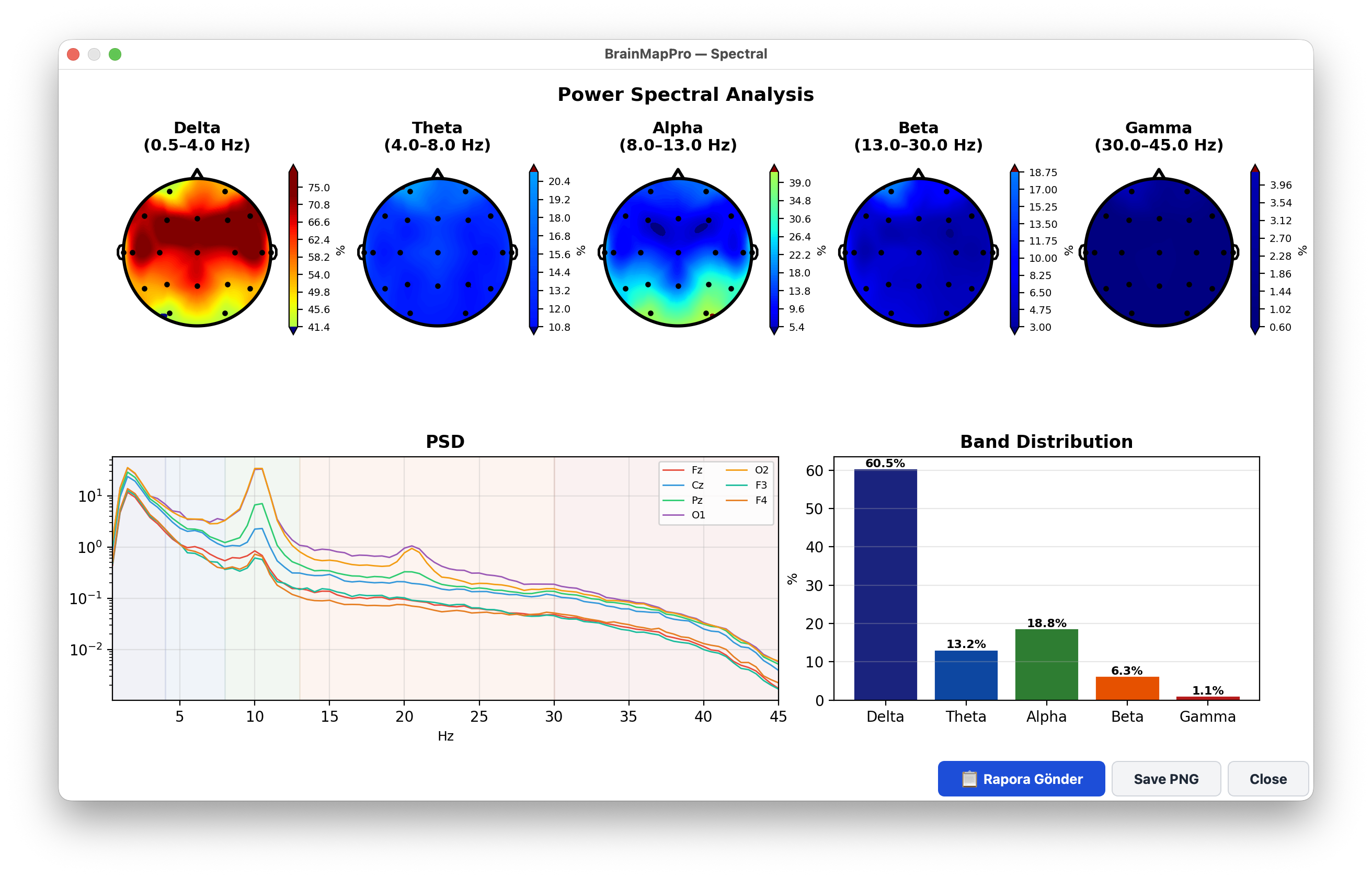 Power spectral analysis with topomaps, PSD and band distribution