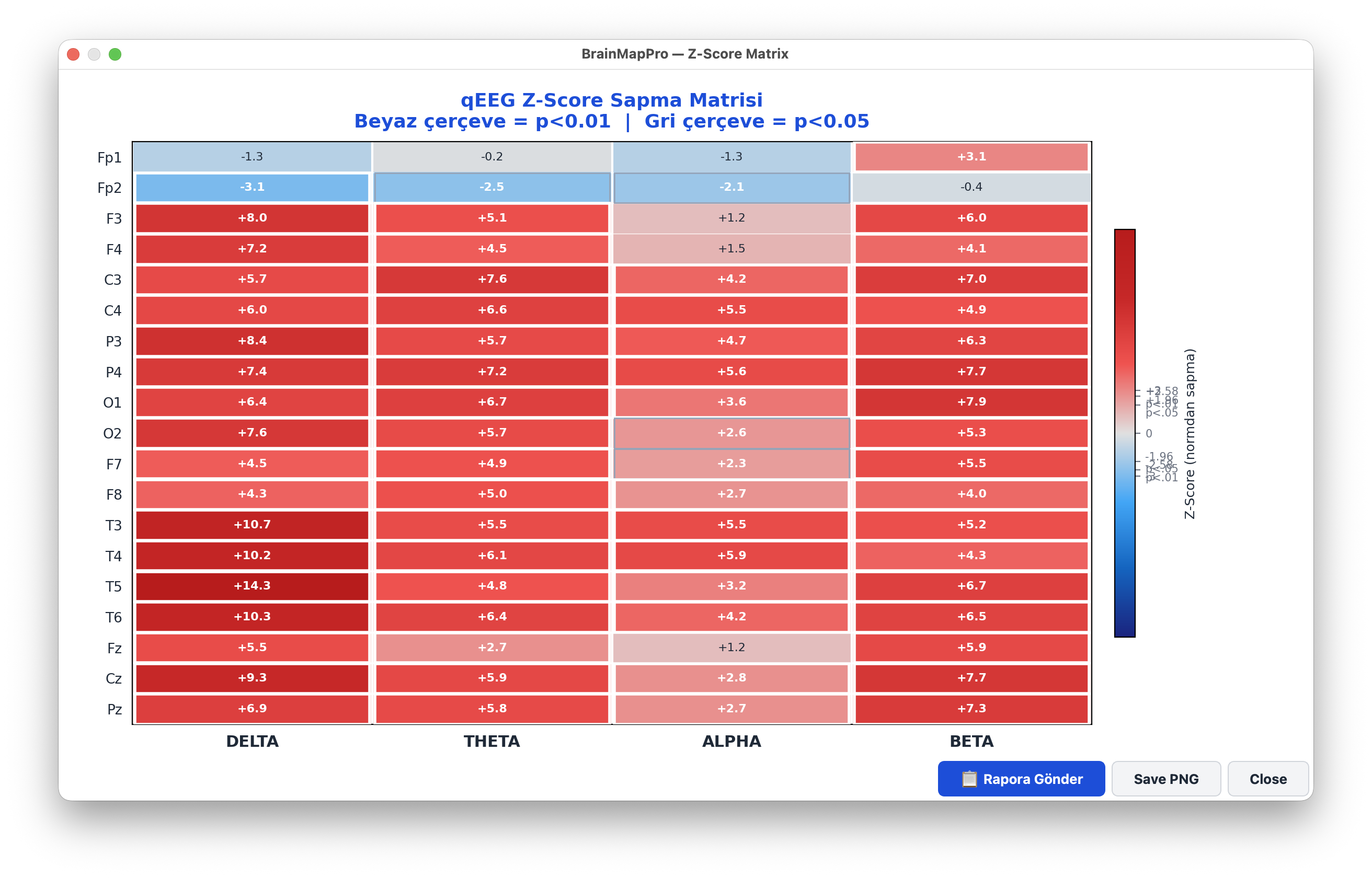 Z-score deviation matrix heatmap for all channels and bands