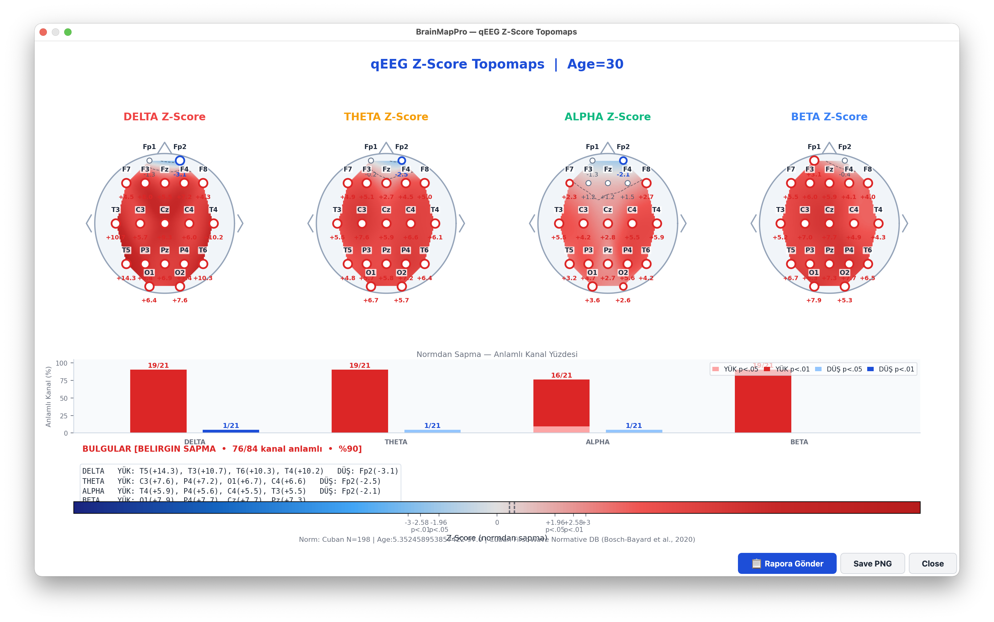Z-score topographic maps with normative comparison